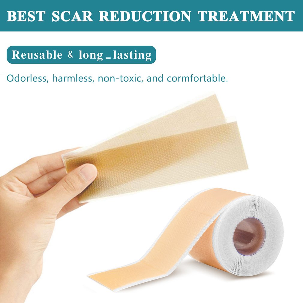 4cm X 150cm Silicone Scar Shee - Skincare X Beauty ulasan dan harga