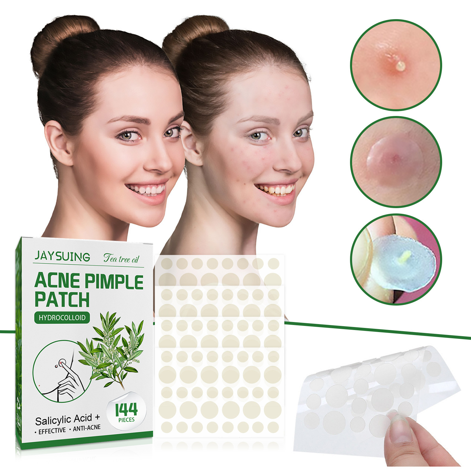 Hydrocolloid Acne Patches - Ab - Hydrocolloid Acne Patch ulasan dan harga