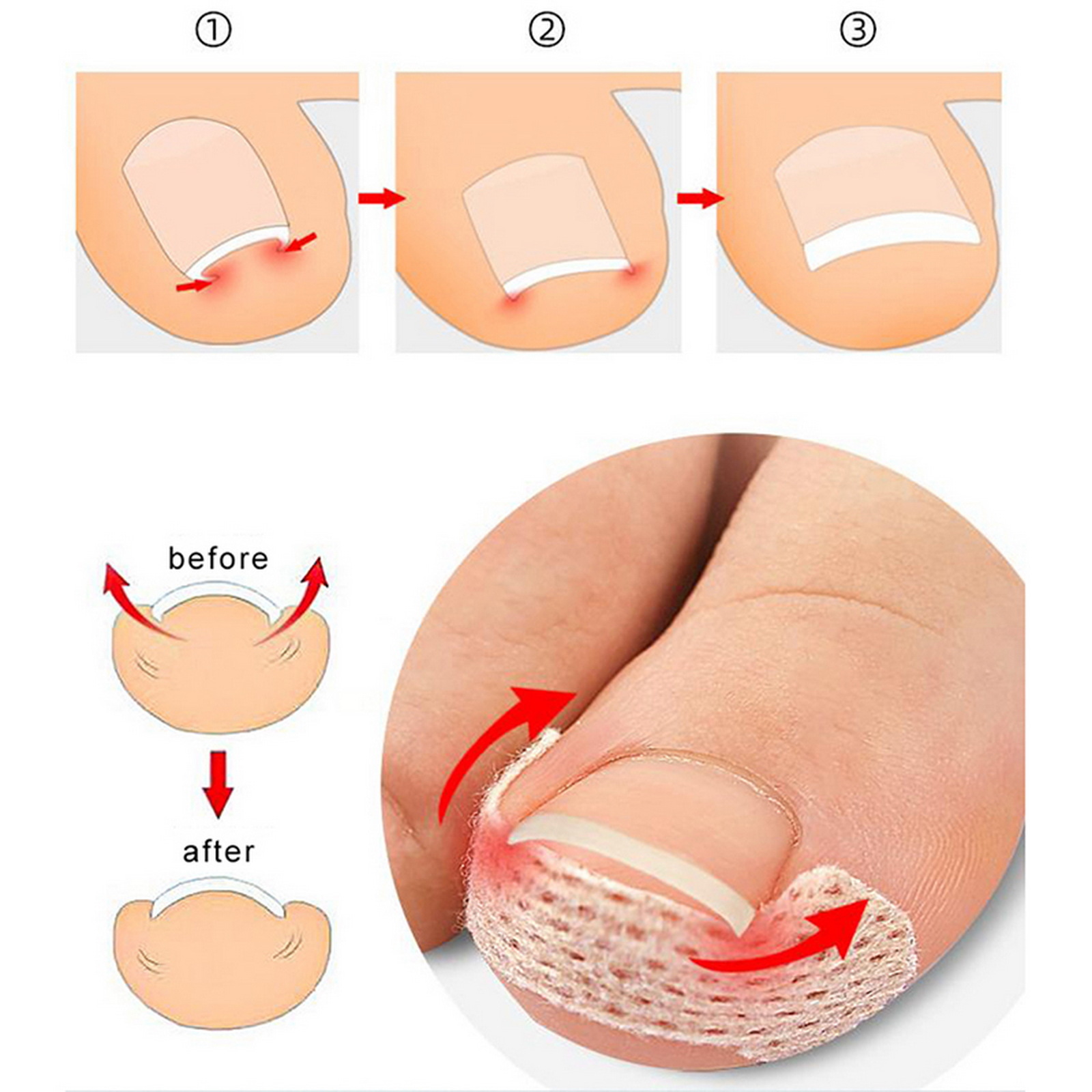 10-100Pcs Adhesive Toenail Pat - Skincare Oily Skin ulasan dan harga